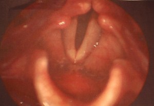 "my vocal cords." by Flickr user Dan Simpson, CC BY-NC 2.0